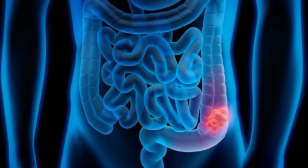 Best Cancer specialist in Patiala