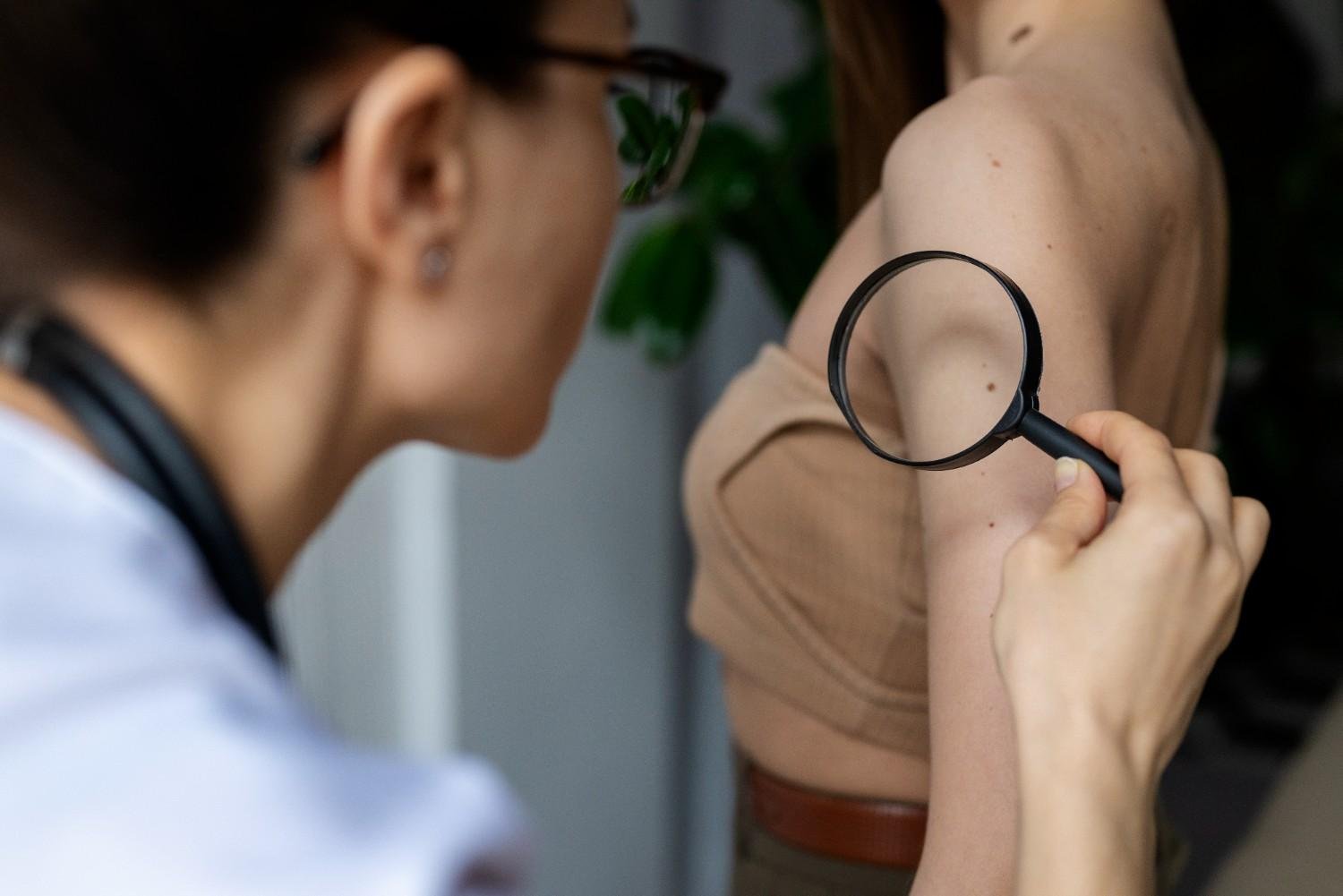 Best Skin Cancer Specialist in Patiala