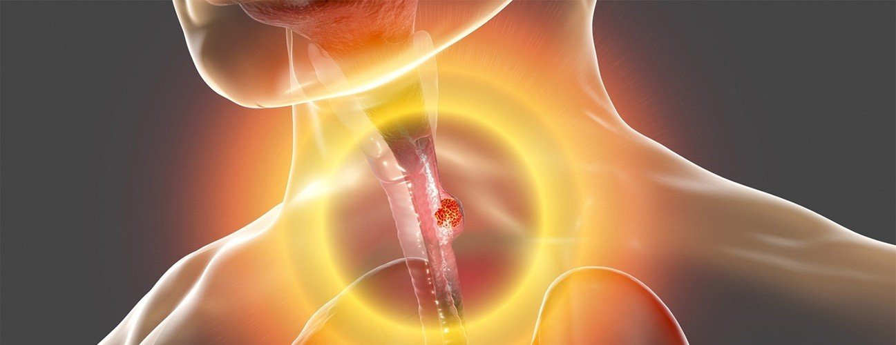 Best Food Pipe Cancer Specialist in Punjab