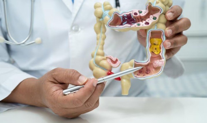 Best Colon Cancer Treatment in Punjab