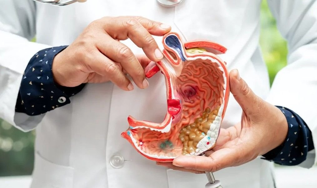 Best Stomach Cancer Doctor in Ambala