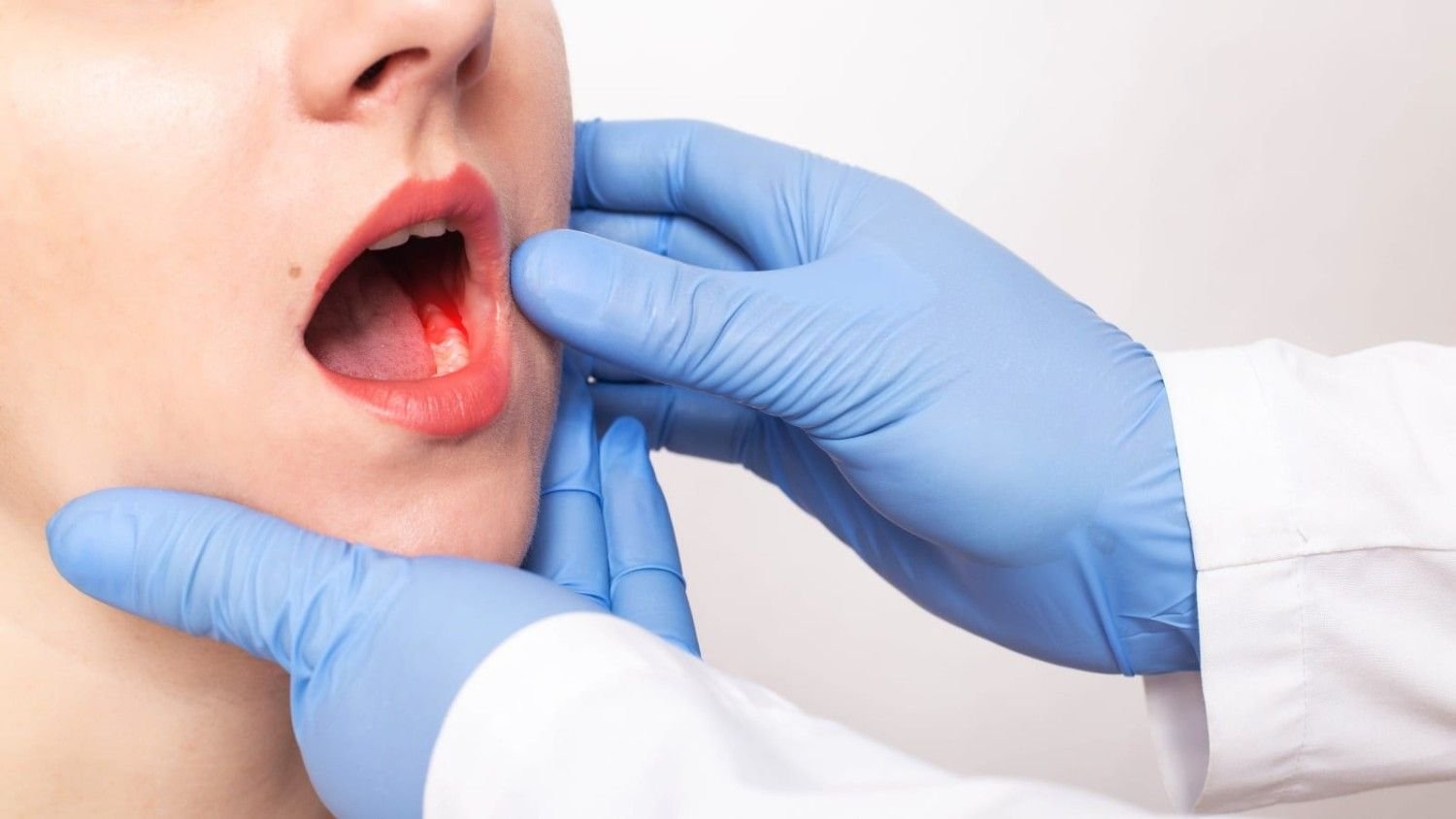 Best Oral Cancer Treatment in Punjab