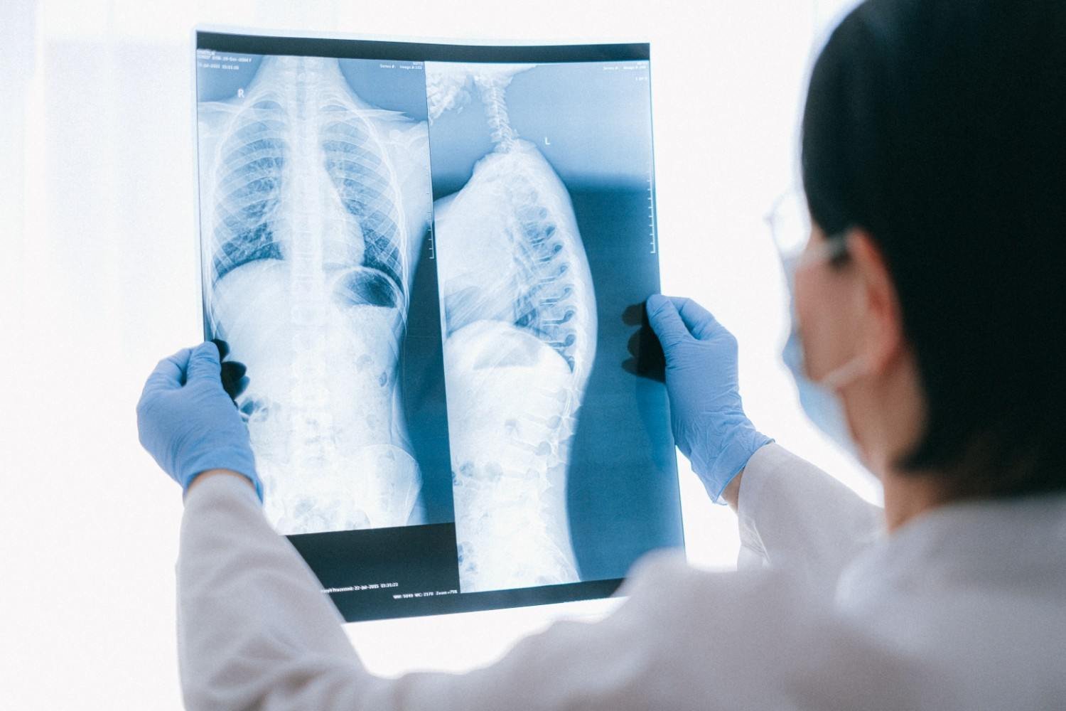 Lung Cancer Specialist in Ambala